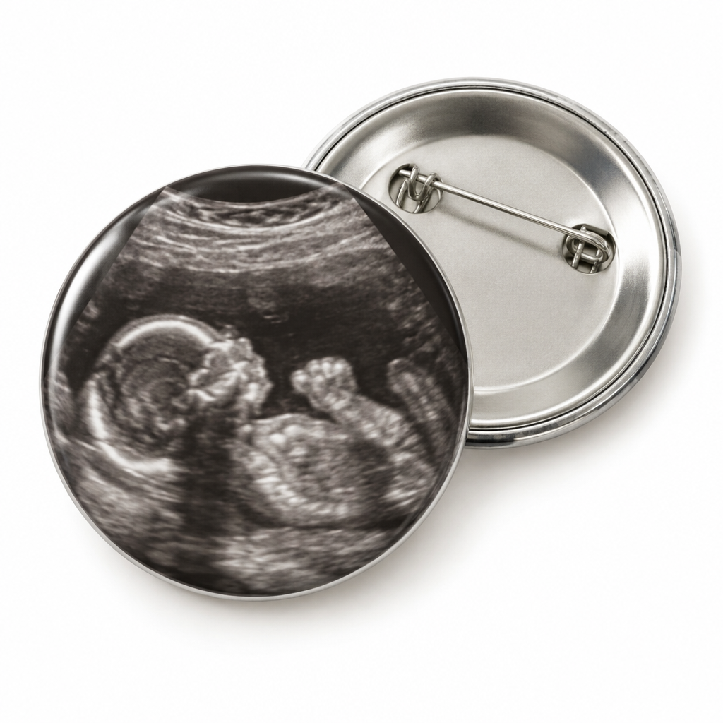 Custom Baby Ultrasound Picture Pin Button 2.25-inch